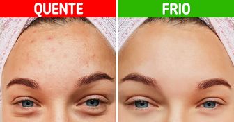 5 Maravilhas que um banho frio pode fazer por sua pele