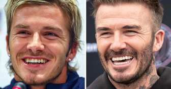 17 Celebridades que repaginaram os dentes e devolveram brilho ao sorriso