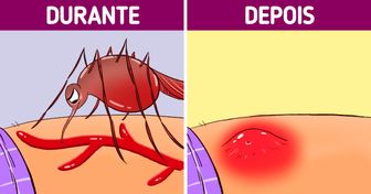 O que acontece com seu corpo após ser picado por um mosquito