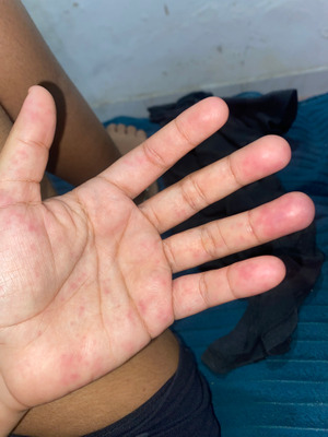 Comentário com imagem no Incrível.club