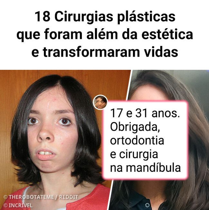 18 Cirurgias plásticas que foram além da estética e transformaram vidas