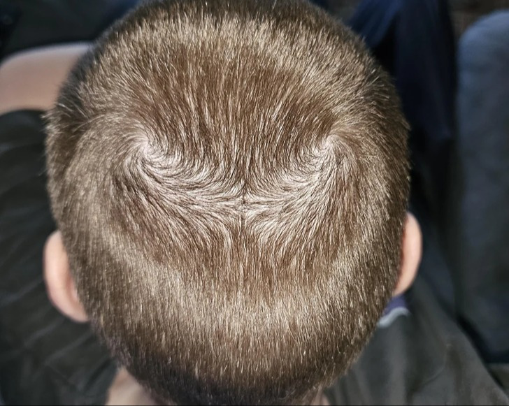 3. "Eu tenho duas coroas - é bem esquisito"