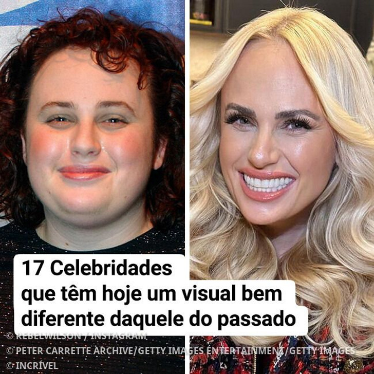 17 Celebridades queridas pelo público e que têm hoje um visual bem diferente daquele do passado