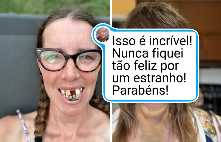 16 Casos de cirurgias que curaram por dentro e por fora
