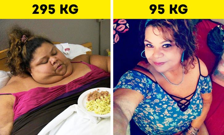 Dr. Nowzaradan motiva a Bethany a perder 27 KG en 2 meses