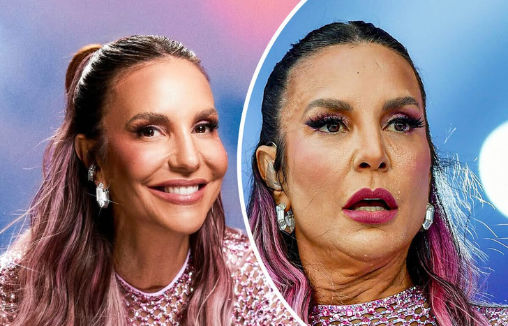 18 Closes em famosos que provam que a perfeição não existe de verdade