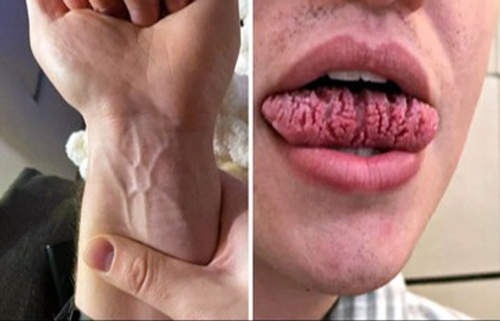 Mutações genéticas tão únicas que viralizaram com milhares de curtidas