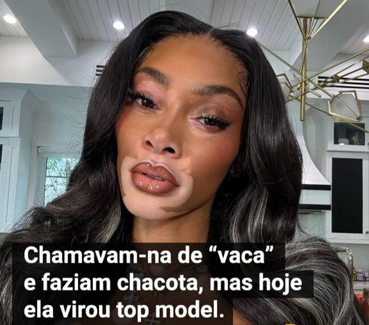 Chamavam-na de “vaca” e faziam chacota, mas ela virou top model
