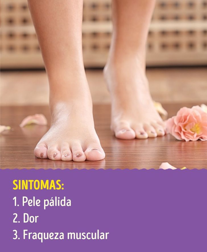 9 Problemas Nas Pernas Que Podem Ser Sinais De Doencas