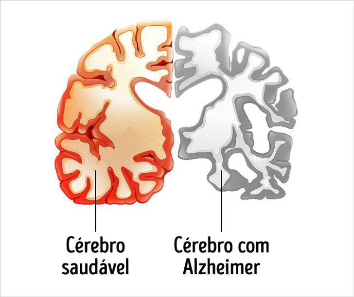 8 Desenhos De Artistas Com Alzheimer Que Mostram O Desenvolvimento Da Doenca