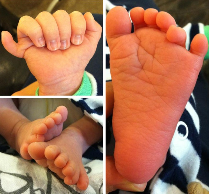 Aparentemente, meu novo sobrinho tem 12 dedos no pé e 12 dedos na mão"