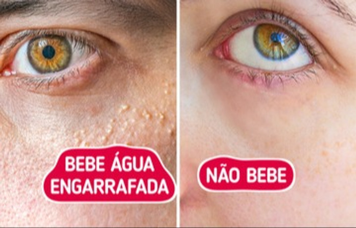 Como os tipos de água afetam nossa saúde, das baratas às mais caras