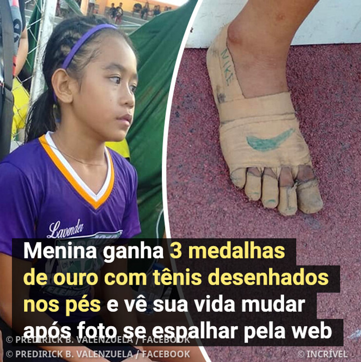 Menina ganha 3 medalhas de ouro com tênis desenhados nos pés e vê sua vida mudar após foto se espalhar pela web