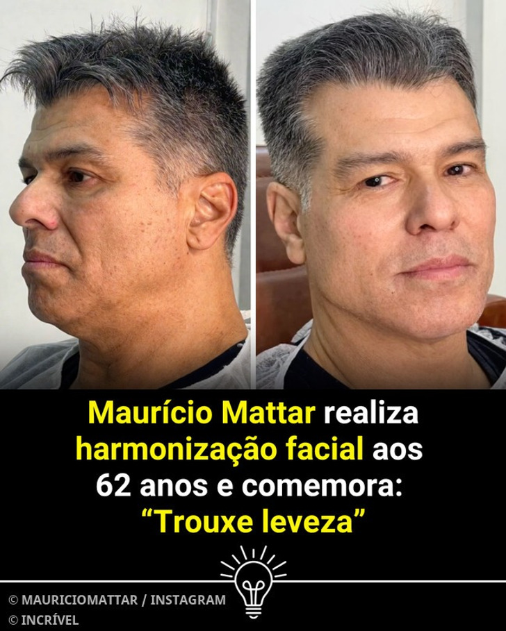 Aos 62 anos, Maurício Mattar surpreendeu seus fãs ao mostrar o resultado de sua harmonização facial. 