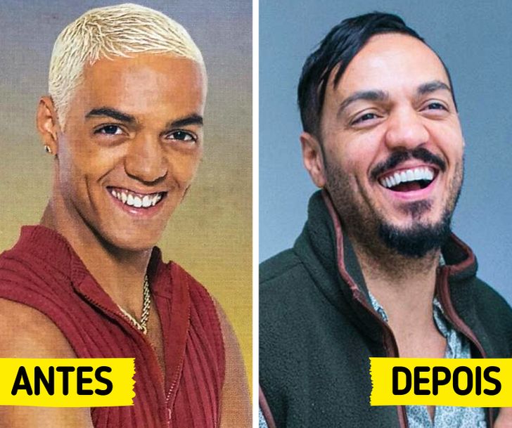 19 Famosos brasileiros que repaginaram os dentes e ganharam sorrisos mais cativantes