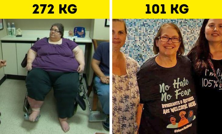 Dr. Nowzaradan motiva a Bethany a perder 27 KG en 2 meses
