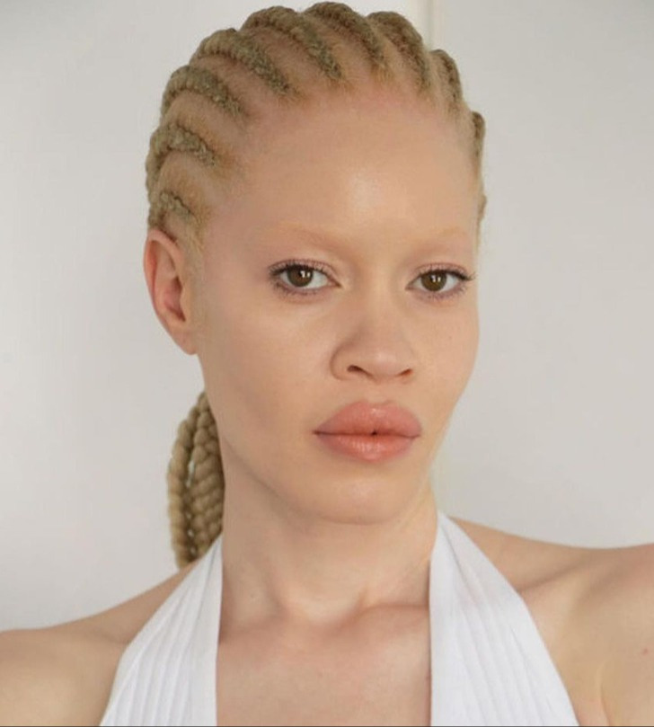 Diandra Forrest nasceu em 22 de outubro de 1989, em Nova York. Desde o nascimento, a futura estrela das passarelas já chamava atenção pelos cabelos e pele extremamente claros, combinados com olhos verdes marcantes. 