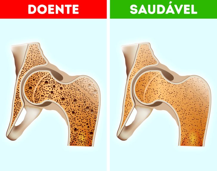 O que acontece se eu ficar sem comer?