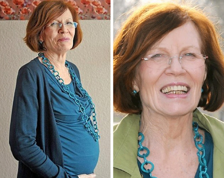 Side-by-side photo of Annegret Raunigk while pregnant and smilling.