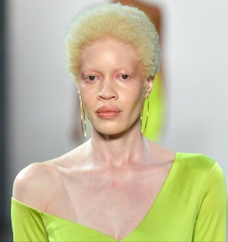 Diandra Forrest com sua irmã e irmãos
