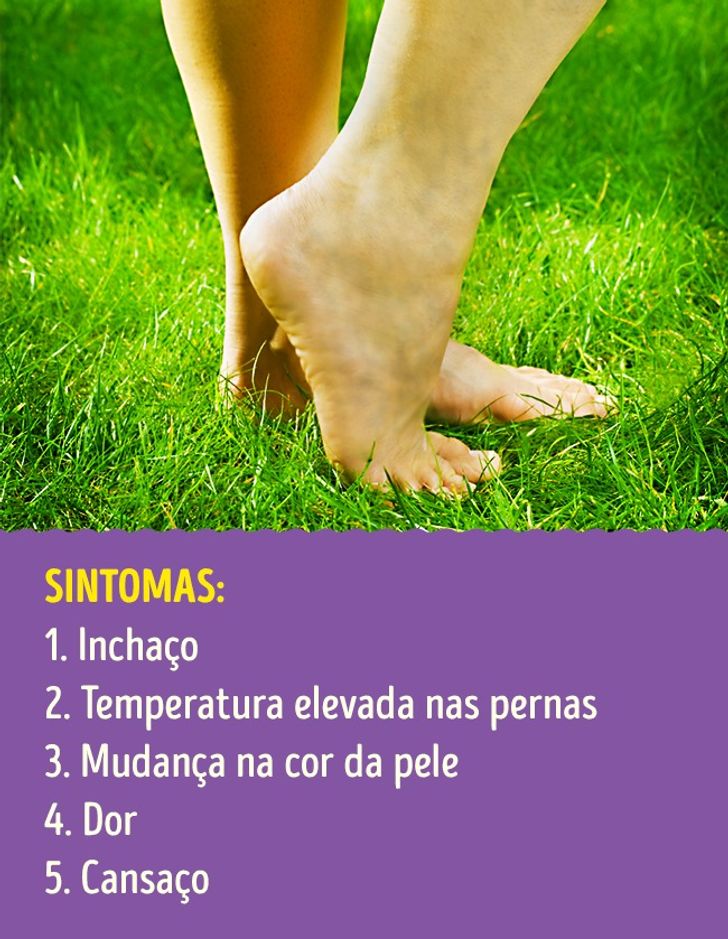 9 Problemas Nas Pernas Que Podem Ser Sinais De Doencas