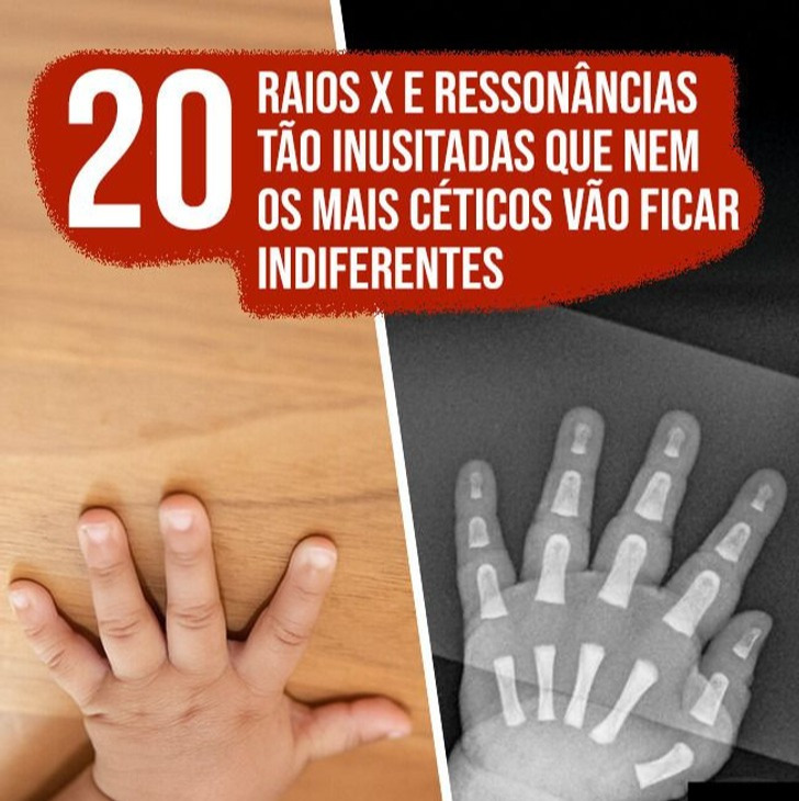 20 Raios X e ressonâncias tão inusitadas que nem os mais céticos vão ficar indiferentes