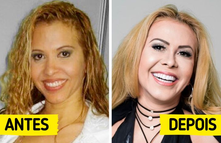 19 Famosos brasileiros que repaginaram os dentes e ganharam sorrisos mais cativantes