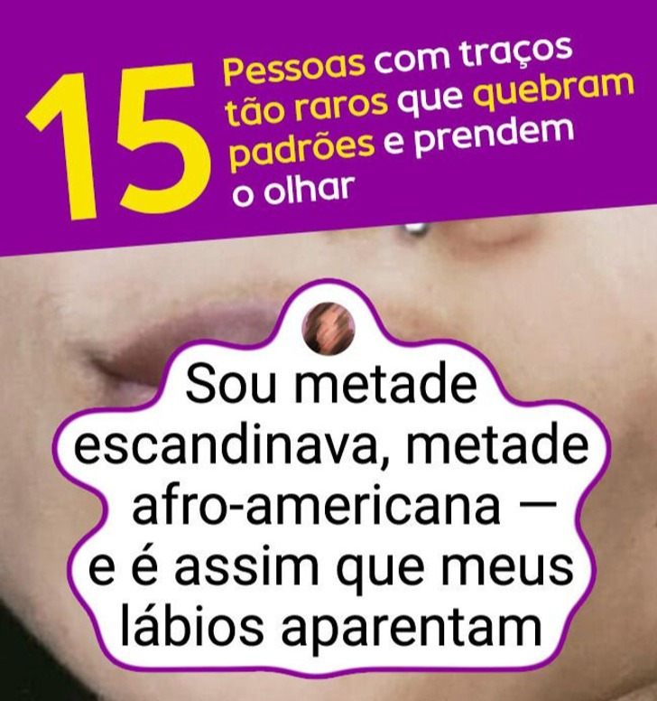 15 Pessoas com traços tão raros que quebram padrões e prendem o olhar