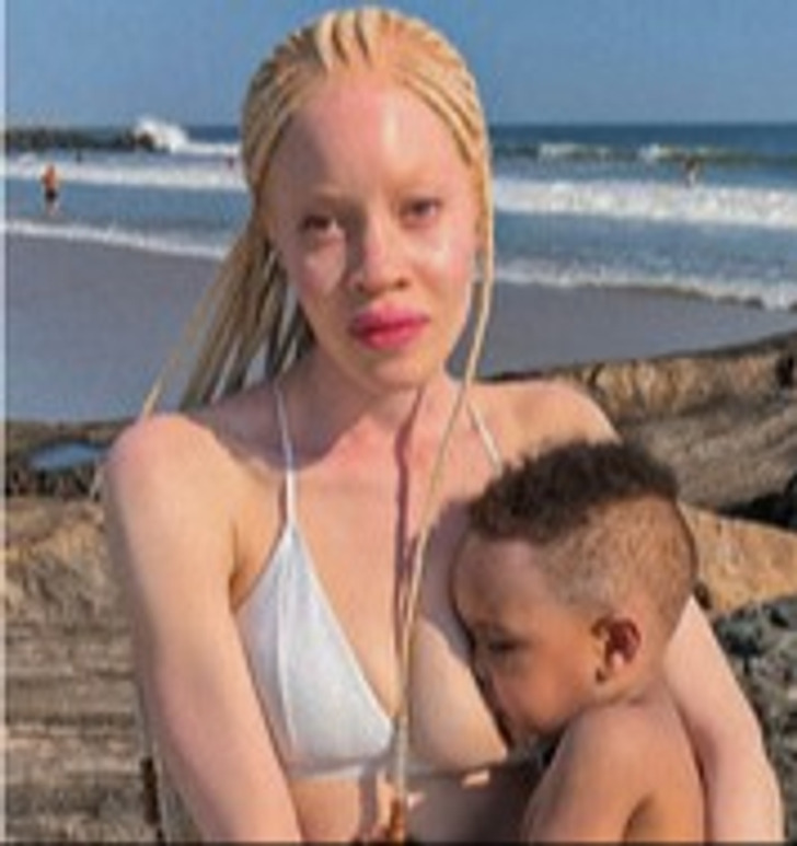 Zombavam do albinismo dela e do sonho de ser modelo, mas ela venceu tudo