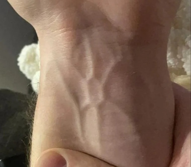 1. "Esta estrutura de veias hexagonais em meu pulso"