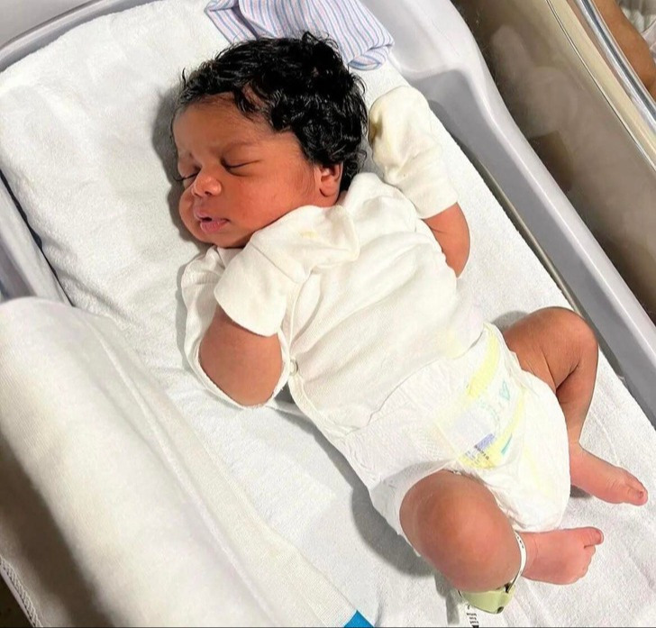 "O bebê está de bruços ou de barriga para cima?"