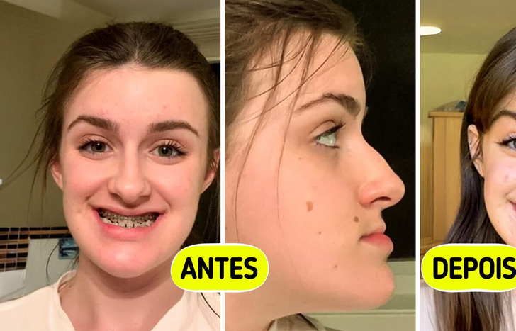 20 Pessoas que viveram uma metamorfose no visual e hoje exibem sua melhor versão