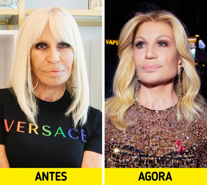 image_alt