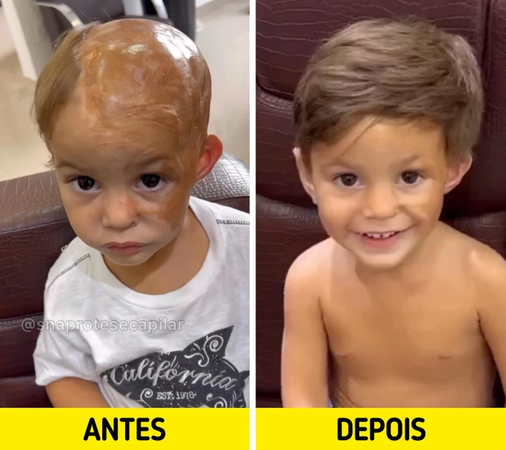 Cabeleireira paulista dá extensões de cabelo gratuitamente para crianças que perderam cabelos por acidentes ou doenças
